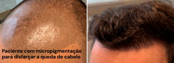 Imagem de Antes e Depois de um paciente da Audra Clínica